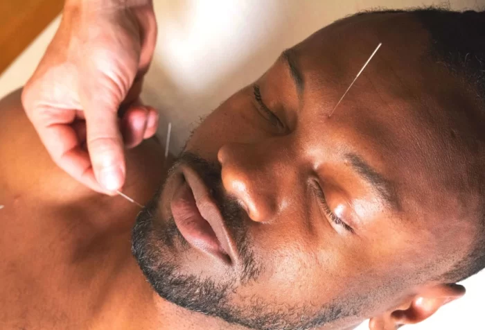 مقاله علمی تاثیر طب سوزنی چینی در علائم و عوارض بیماری ام‌ اس 