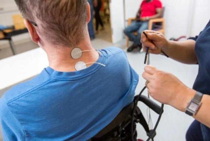 درمان بیماران آسیب نخاعی با تحریک الکتریکی؛ مکانیزم‌ها، کاربردها و شواهد علمی