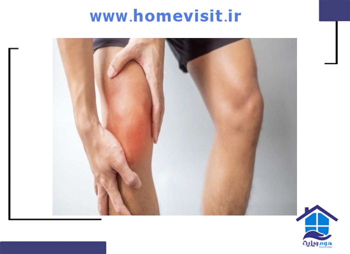تشخیص زودهنگام در درمان نرمی غضروف کشکک زانو