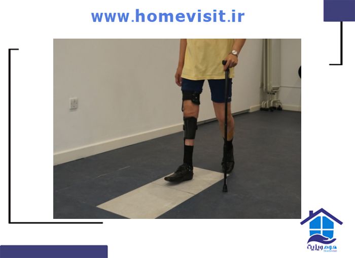 مشکلات در فلج اطفال حرکتی محدودیت در راه رفتن