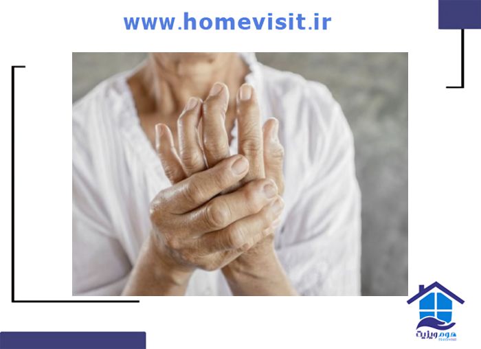 نقش حرکات عصبی در کاهش درد سندروم تونل کارپال