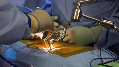 عمل جراحی تنگی کانال نخاعی