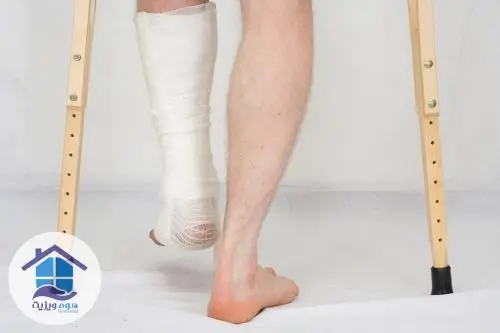 تمرین راه رفتن پس از شکستگی مچ پا