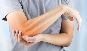 فیزیوتراپی بعد از شکستگی آرنج