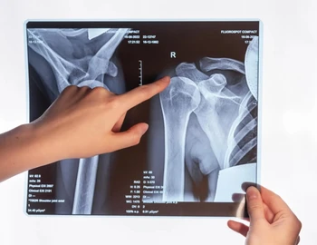 رادیوگرافی شانه در منزل