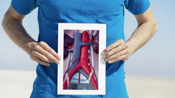 آنوریسم چیست ؟ علائم و نحوه تشخیص آنوریسم